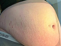 Nomyournoms, a 410lbs mutual gainer From United States